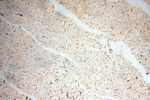 BIN2 Antibody in Immunohistochemistry (Paraffin) (IHC (P))