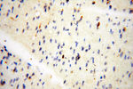 BIN2 Antibody in Immunohistochemistry (Paraffin) (IHC (P))