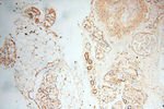 BIN2 Antibody in Immunohistochemistry (Paraffin) (IHC (P))