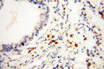 BIN2 Antibody in Immunohistochemistry (Paraffin) (IHC (P))