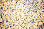 BIN2 Antibody in Immunohistochemistry (Paraffin) (IHC (P))