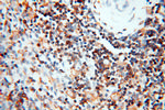 BIN2 Antibody in Immunohistochemistry (Paraffin) (IHC (P))