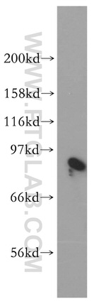 BIN2 Antibody in Western Blot (WB)