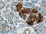 FAM3C Antibody in Immunohistochemistry (Paraffin) (IHC (P))