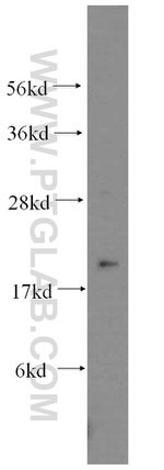 MYL5 Antibody in Western Blot (WB)