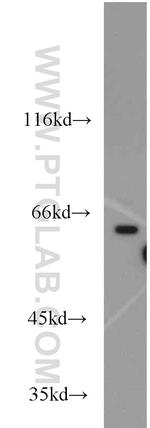 APLF Antibody in Western Blot (WB)