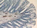 NCAM1/CD56 Antibody in Immunohistochemistry (Paraffin) (IHC (P))