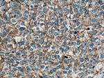 NCAM1/CD56 Antibody in Immunohistochemistry (Paraffin) (IHC (P))