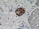 NCAM1/CD56 Antibody in Immunohistochemistry (Paraffin) (IHC (P))