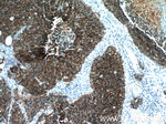 NCAM1/CD56 Antibody in Immunohistochemistry (Paraffin) (IHC (P))
