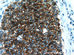 NCAM1/CD56 Antibody in Immunohistochemistry (Paraffin) (IHC (P))