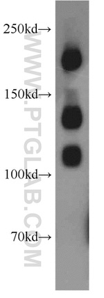 NCAM1/CD56 Antibody in Western Blot (WB)