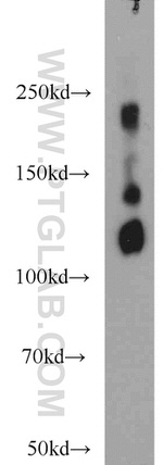 NCAM1/CD56 Antibody in Western Blot (WB)