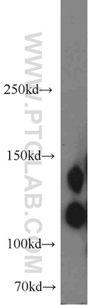 NCAM1/CD56 Antibody in Western Blot (WB)