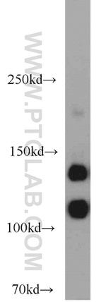 NCAM1/CD56 Antibody in Western Blot (WB)