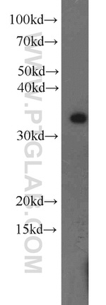 MBD3 Antibody in Western Blot (WB)