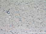Syntaxin 12 Antibody in Immunohistochemistry (Paraffin) (IHC (P))