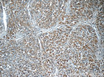 ITPKC Antibody in Immunohistochemistry (Paraffin) (IHC (P))