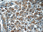 ITPKC Antibody in Immunohistochemistry (Paraffin) (IHC (P))