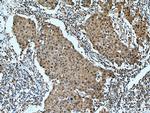 ITPKC Antibody in Immunohistochemistry (Paraffin) (IHC (P))