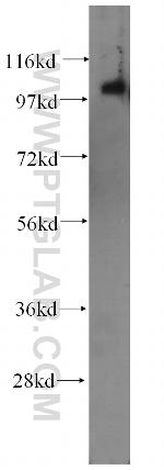 ITPKC Antibody in Western Blot (WB)