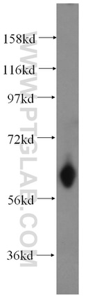 ABCG4 Antibody in Western Blot (WB)