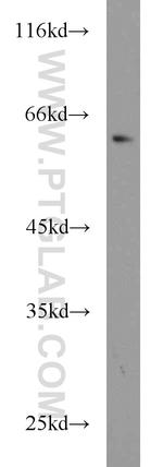 ABCG4 Antibody in Western Blot (WB)