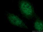 CEBPE Antibody in Immunocytochemistry (ICC/IF)