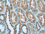 GFM1 Antibody in Immunohistochemistry (Paraffin) (IHC (P))