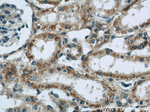 CNOT1 Antibody in Immunohistochemistry (Paraffin) (IHC (P))