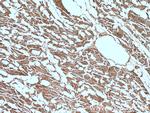 CNOT1 Antibody in Immunohistochemistry (Paraffin) (IHC (P))