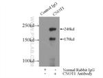 CNOT1 Antibody in Immunoprecipitation (IP)