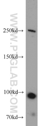 CNOT1 Antibody in Western Blot (WB)