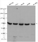 COG6 Antibody in Western Blot (WB)