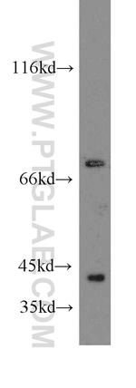 COG6 Antibody in Western Blot (WB)