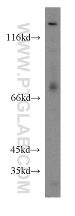 COG6 Antibody in Western Blot (WB)