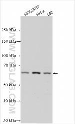 SUPT3H Antibody in Western Blot (WB)