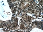 ZWILCH Antibody in Immunohistochemistry (Paraffin) (IHC (P))