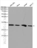 ARHGDIG Antibody in Western Blot (WB)
