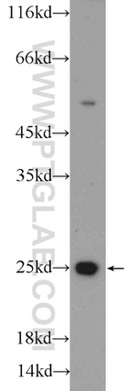 ARHGDIG Antibody in Western Blot (WB)