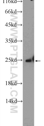 ARHGDIG Antibody in Western Blot (WB)