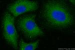 SFRP5 Antibody in Immunocytochemistry (ICC/IF)
