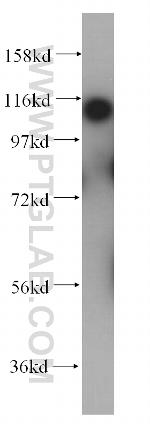 HLTF Antibody in Western Blot (WB)