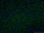 LRRTM1 Antibody in Immunohistochemistry (PFA fixed) (IHC (PFA))