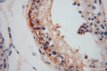 LRRTM1 Antibody in Immunohistochemistry (Paraffin) (IHC (P))
