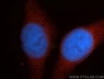 Renin Antibody in Immunocytochemistry (ICC/IF)