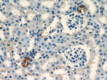 Renin Antibody in Immunohistochemistry (Paraffin) (IHC (P))