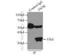 FN3K Antibody in Immunoprecipitation (IP)