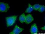 APPL2 Antibody in Immunocytochemistry (ICC/IF)