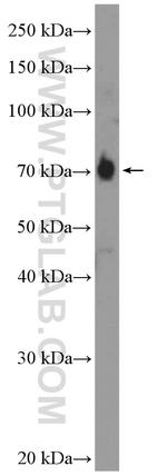 APPL2 Antibody in Western Blot (WB)